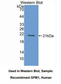 https://msimg.bioon.com/bionline/goods-no-pic.png