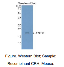 https://msimg.bioon.com/bionline/goods-no-pic.png