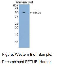 人胎球蛋白B(FETUB)多克隆抗体