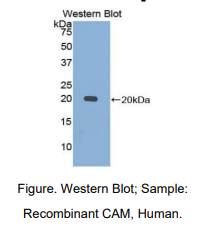 https://msimg.bioon.com/bionline/goods-no-pic.png