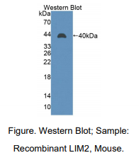 小鼠晶状体内膜蛋白2(LIM2)多克隆抗体