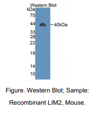 https://msimg.bioon.com/bionline/goods-no-pic.png