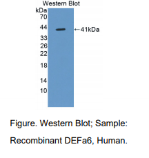 人防御素α6(DEFa6)多克隆抗体