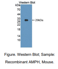 https://msimg.bioon.com/bionline/goods-no-pic.png