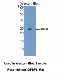 https://msimg.bioon.com/bionline/goods-no-pic.png