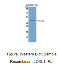 https://msimg.bioon.com/bionline/goods-no-pic.png