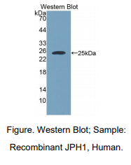 人连接蛋白1(JPH1)多克隆抗体