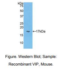 https://msimg.bioon.com/bionline/goods-no-pic.png