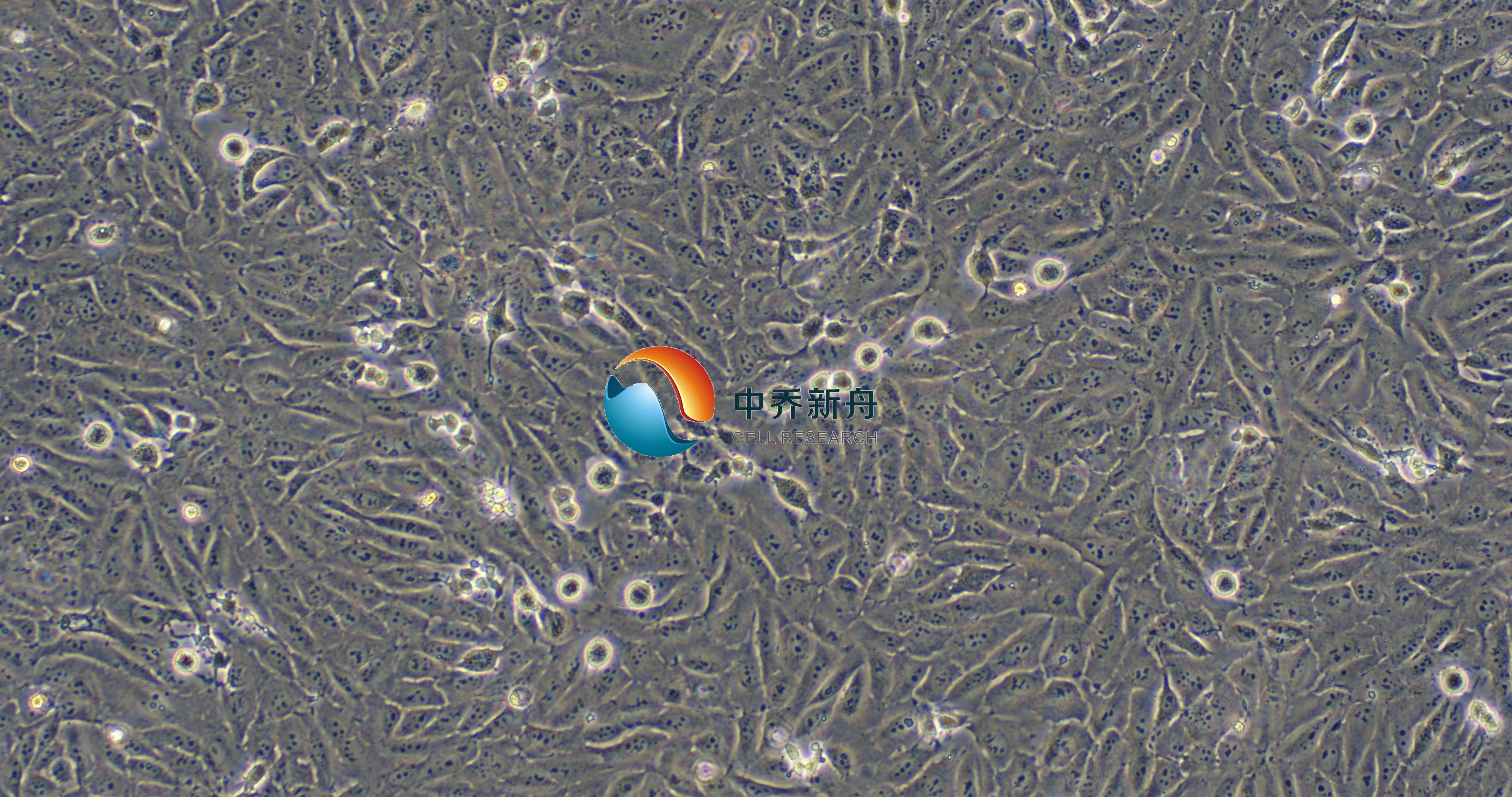 143B-GFP+LUC人骨肉瘤细胞-绿色+荧光素酶标记