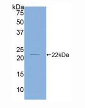 人丝切蛋白2(CFL2)多克隆抗体