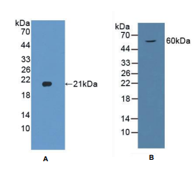 https://msimg.bioon.com/bionline/goods-no-pic.png