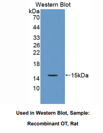 https://msimg.bioon.com/bionline/goods-no-pic.png