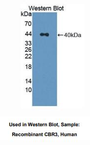 人羰基还原酶3(CBR3)多克隆抗体