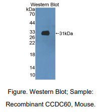 https://msimg.bioon.com/bionline/goods-no-pic.png