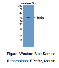 https://msimg.bioon.com/bionline/goods-no-pic.png