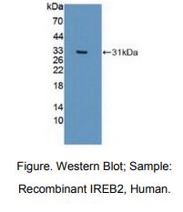 人铁反应元件结合蛋白2(IREB2)多克隆抗体