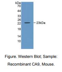 https://msimg.bioon.com/bionline/goods-no-pic.png