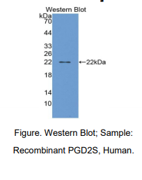 人前列腺素D2合成酶(PTGDS)多克隆抗体