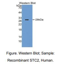 人斯钙素2(STC2)多克隆抗体
