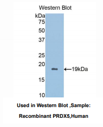 https://msimg.bioon.com/bionline/goods-no-pic.png