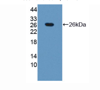 https://msimg.bioon.com/bionline/goods-no-pic.png