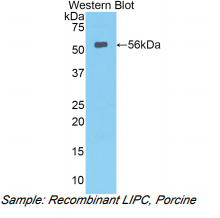 猪肝脂酶(LIPC)多克隆抗体