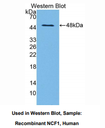 https://msimg.bioon.com/bionline/goods-no-pic.png