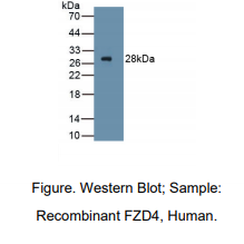 https://msimg.bioon.com/bionline/goods-no-pic.png