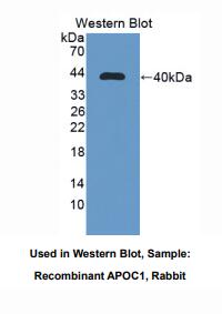 https://msimg.bioon.com/bionline/goods-no-pic.png