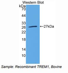 https://msimg.bioon.com/bionline/goods-no-pic.png