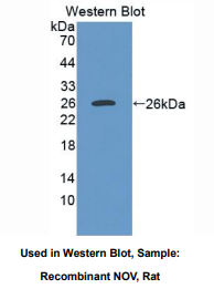 大鼠肾母细胞瘤过表达基因(NOV)多克隆抗体
