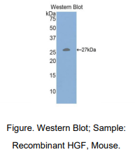 https://msimg.bioon.com/bionline/goods-no-pic.png