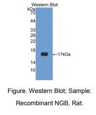 大鼠脑红蛋白(NGB)多克隆抗体