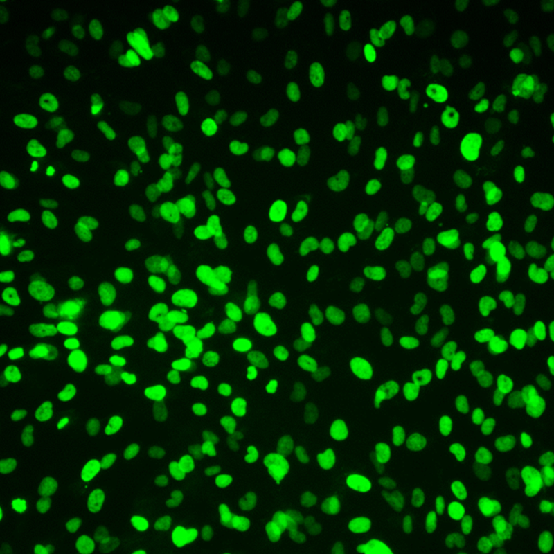 https://img.medsci.cn/9f089b7aa4b707477b959a6e2ad216a893d9b9bafc5aade5ae0577000cb7e602.jpg