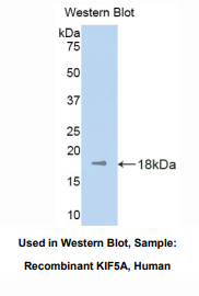 https://msimg.bioon.com/bionline/goods-no-pic.png