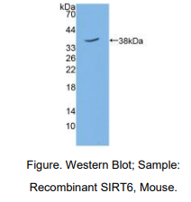 小鼠沉默调节蛋白6(SIRT6)多克隆抗体
