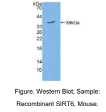 https://msimg.bioon.com/bionline/goods-no-pic.png