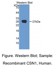 https://msimg.bioon.com/bionline/goods-no-pic.png