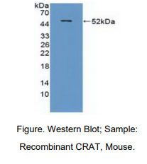 https://msimg.bioon.com/bionline/goods-no-pic.png