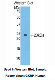 人葡萄糖激酶调节蛋白(GKRP)多克隆抗体