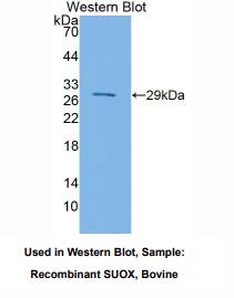 https://msimg.bioon.com/bionline/goods-no-pic.png