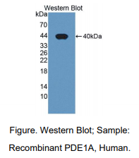 https://msimg.bioon.com/bionline/goods-no-pic.png