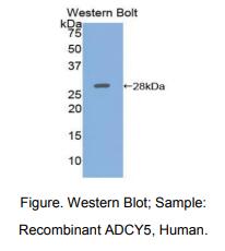 人腺苷酸环化酶5(ADCY5)多克隆抗体