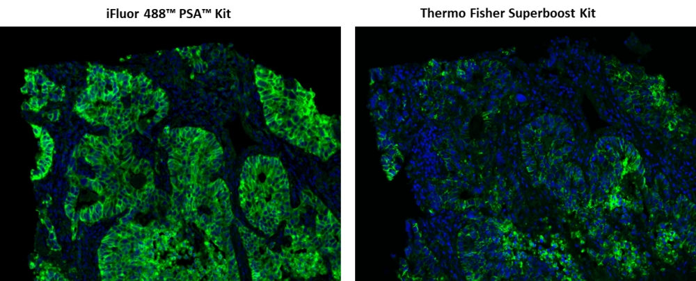 AAT Bioquest iFluor 488 Styramide超级信号放大成像试剂盒 货号45205