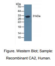 https://msimg.bioon.com/bionline/goods-no-pic.png