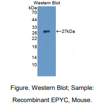 https://msimg.bioon.com/bionline/goods-no-pic.png