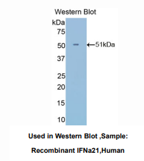 https://msimg.bioon.com/bionline/goods-no-pic.png