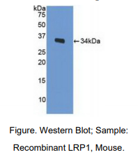 https://msimg.bioon.com/bionline/goods-no-pic.png