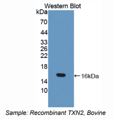 https://msimg.bioon.com/bionline/goods-no-pic.png