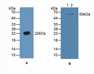 https://msimg.bioon.com/bionline/goods-no-pic.png